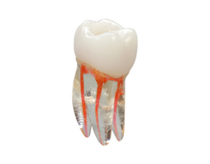 Endodontyczny model zęba